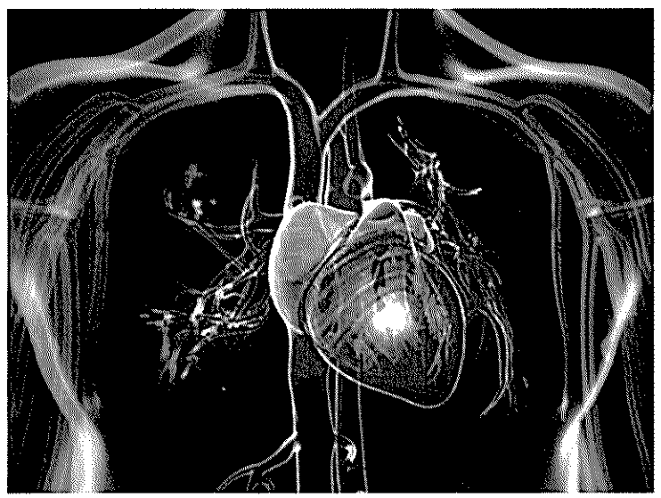 XENS-PSI-modelisation-2022-coeur-support XENS-PSI-modelisation-2022-coeur-support