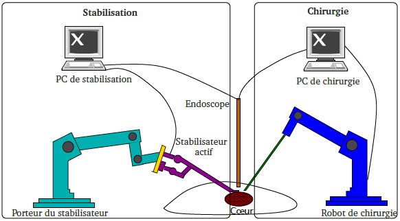 CCS-TSI-SI1-2012-StabilisateurCardiaqueActif-Support CCS-TSI-SI1-2012-StabilisateurCardiaqueActif-Support